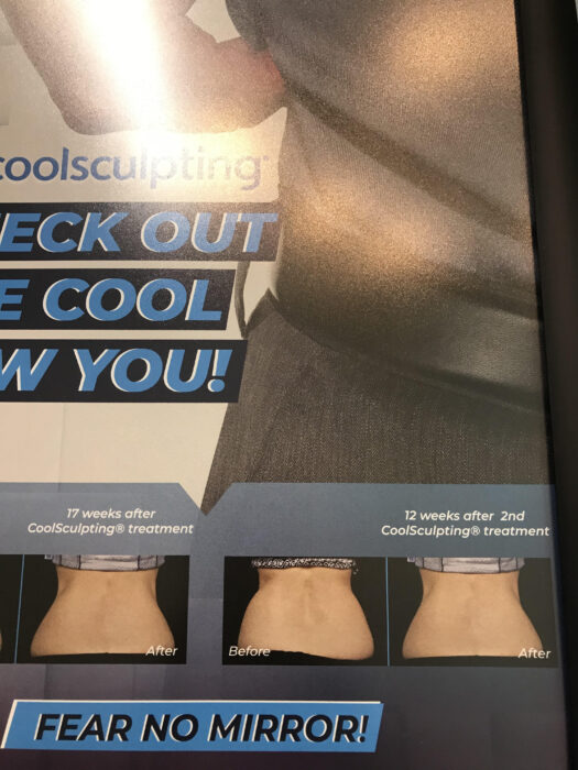 cool sculpting advertisement