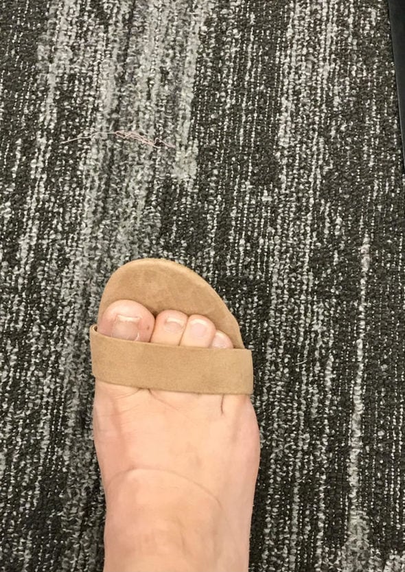 A foot that doesn't fit in a formal shoe.