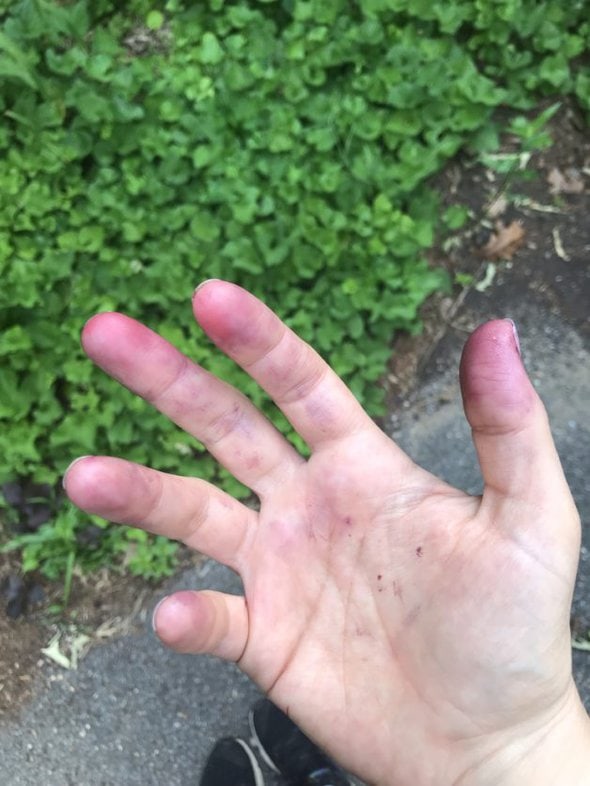 fingers stained with mulberry juice.