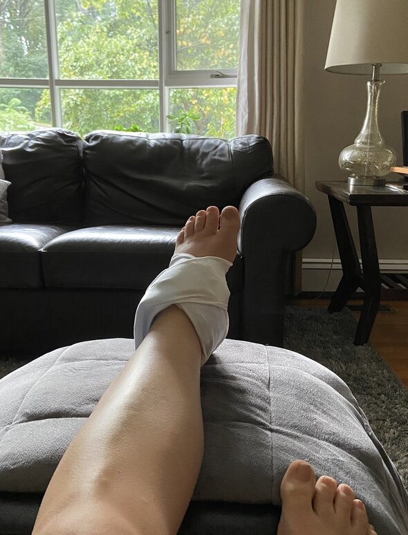 ice pack on ankle.